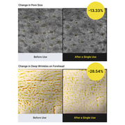 Celimax Layered Retinal Booster - 11× Faster Than Retinol — Without 11× Irritation (2 biodance collagen mask free)