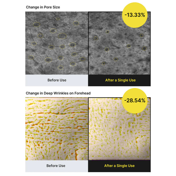 Celimax Layered Retinal Booster - 11× Faster Than Retinol — Without 11× Irritation (2 biodance collagen mask free)