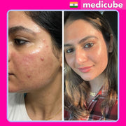 MEDICUBE COLLAGEN NIGHT WRAPPING MASK (BOGO)
