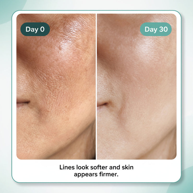 Celimax Layered Retinal Booster - 11× Faster Than Retinol — Without 11× Irritation (2 biodance collagen mask free)